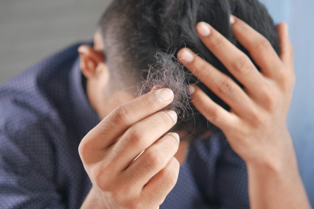 Hair Loss: Complete Guide to Understanding Causes and Exploring Solutions WeightRevive | Hair Loss: Complete Guide to Understanding Causes and Exploring Solutions