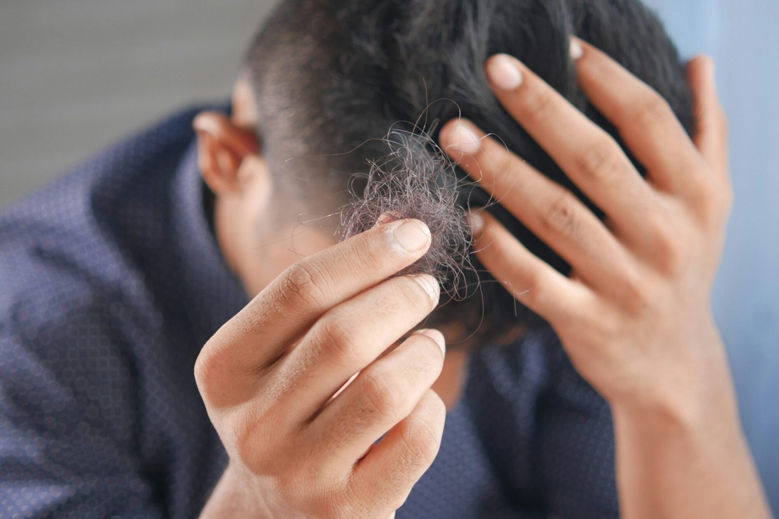 WeightRevive | Hair Loss: Complete Guide to Understanding Causes and Exploring Solutions
